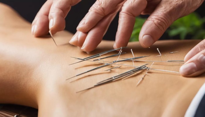 Acupuncture Services